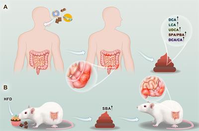 Secondary Bile Acids and Tumorigenesis in Colorectal Cancer